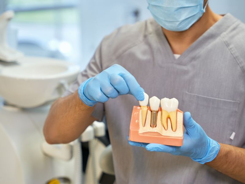 El Proceso de Oseointegración en Implantes Dentales