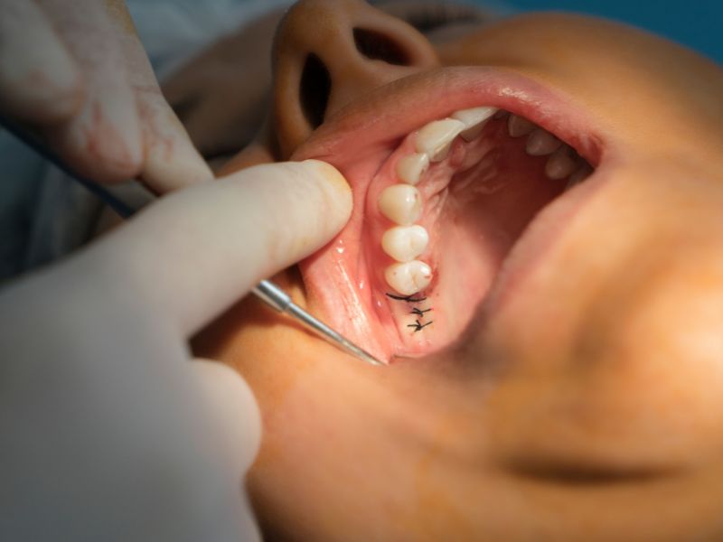 cirugía maxilofacial